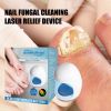 South Moon Nail Fungal Cleaning Laser Relief Device, Gray Nail Bad Nail Thickening Soft Nail Bright Nail Care Instrument